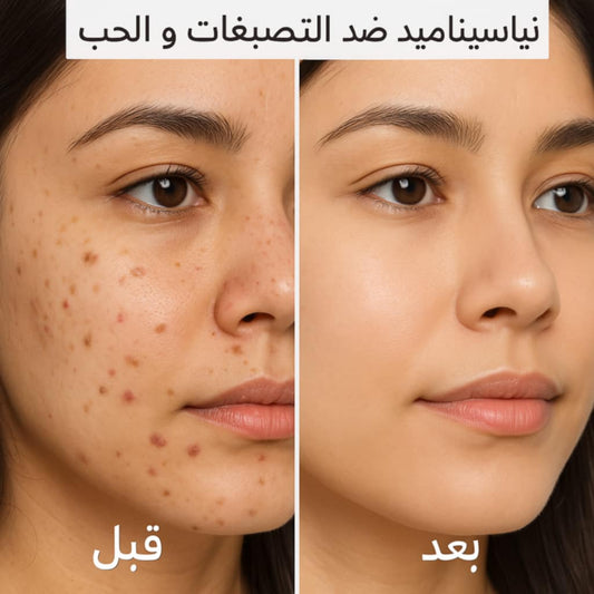 سيروم النياسيناميد مضاد لتصبغات مدعم بعرق السوس و الهيلورونيك و البثنول