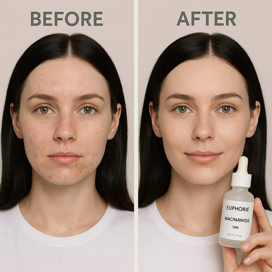 سيروم النياسيناميد مضاد لتصبغات مدعم بعرق السوس و الهيلورونيك و البثنول