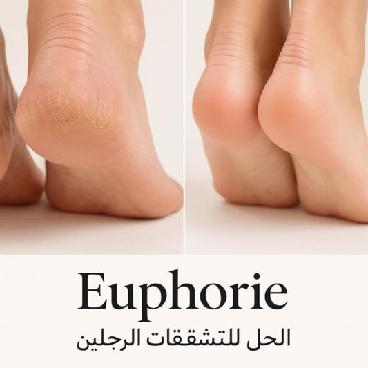 كريم يعالج تشققات الرجلين من أول استخدام